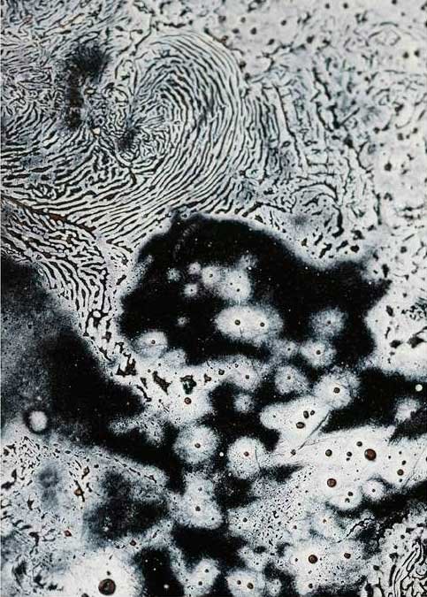 Retin-ES Soft al microscopio
