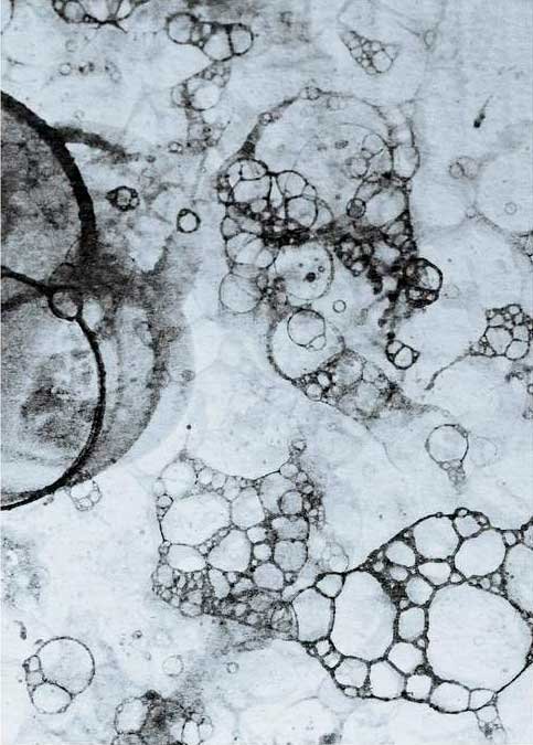 Retin-ES Ultra al microscopio